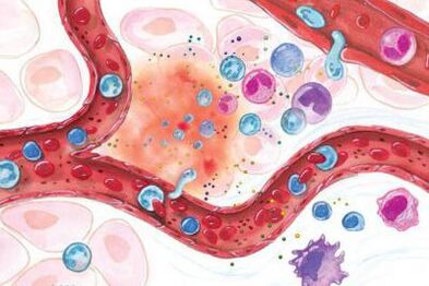 Boswellia poveikis uždegiminėms kūno vietoms