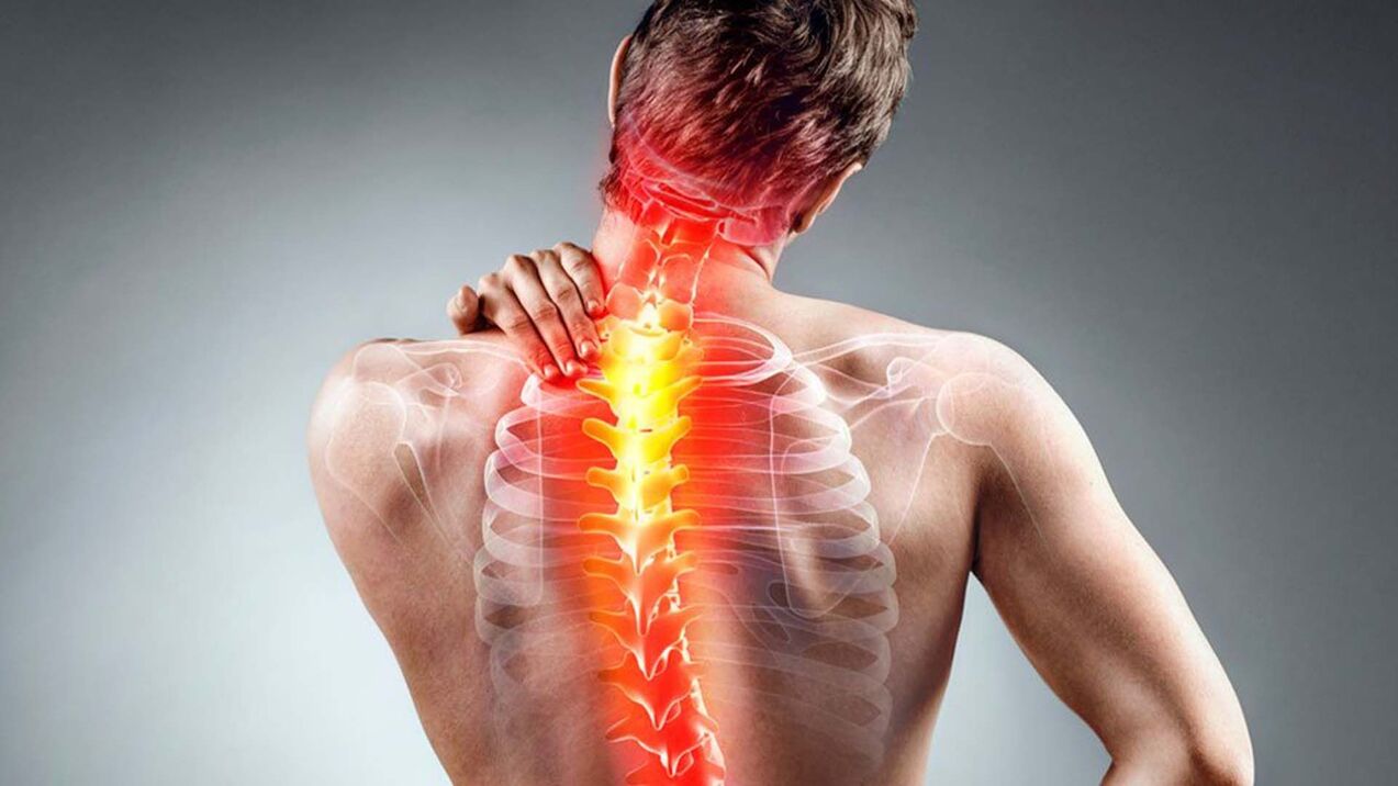 stuburo osteochondrozės simptomai
